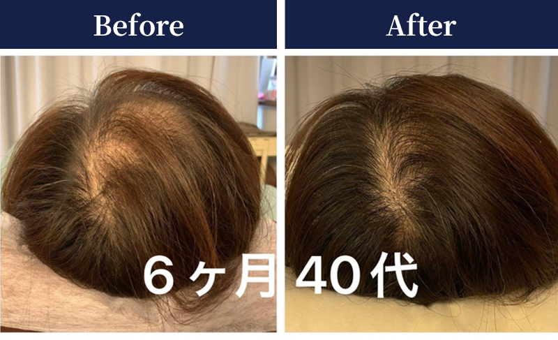 ビフォーアフター